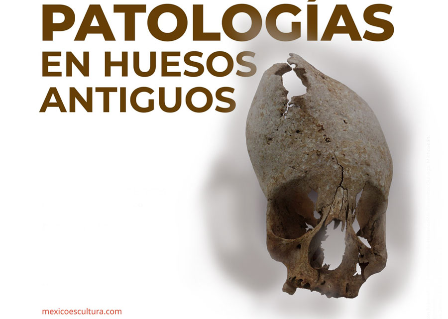Patologías en huesos antiguos